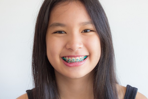 How Braces Can Improve Your Smile And Your Oral Health Henry Orthodontics Pinehurst North 