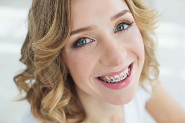 Are Adult Braces Worth It?