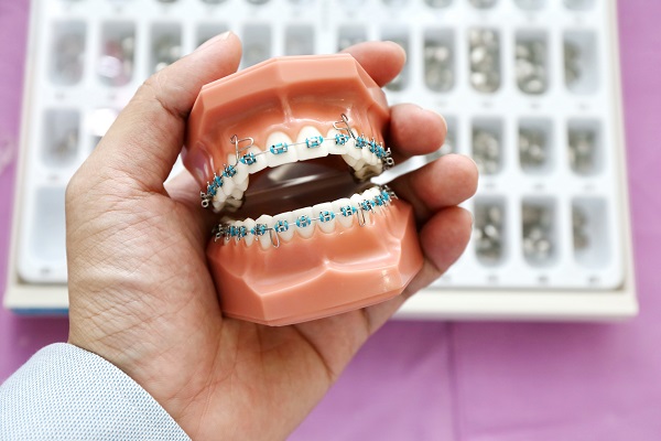 Be Vigilant With Dental Care While Wearing Braces - Henry Orthodontics  Pinehurst, North Carolina