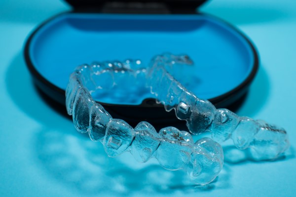 Important Things To Know Before Clear Aligners Teeth Straightening