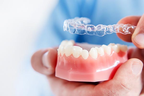Teeth Straightening With Clear Aligners