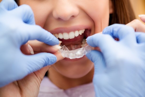 How Invisalign® Works To Straighten Teeth