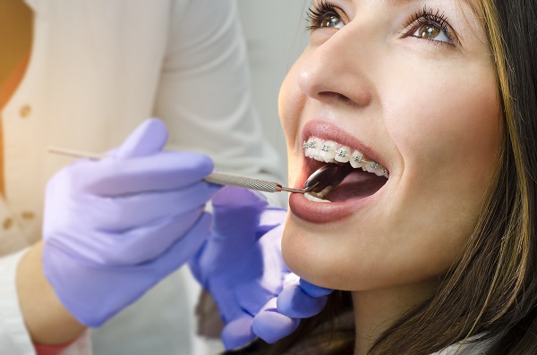 Ask An Orthodontist: Do I Have A Bad Bite?